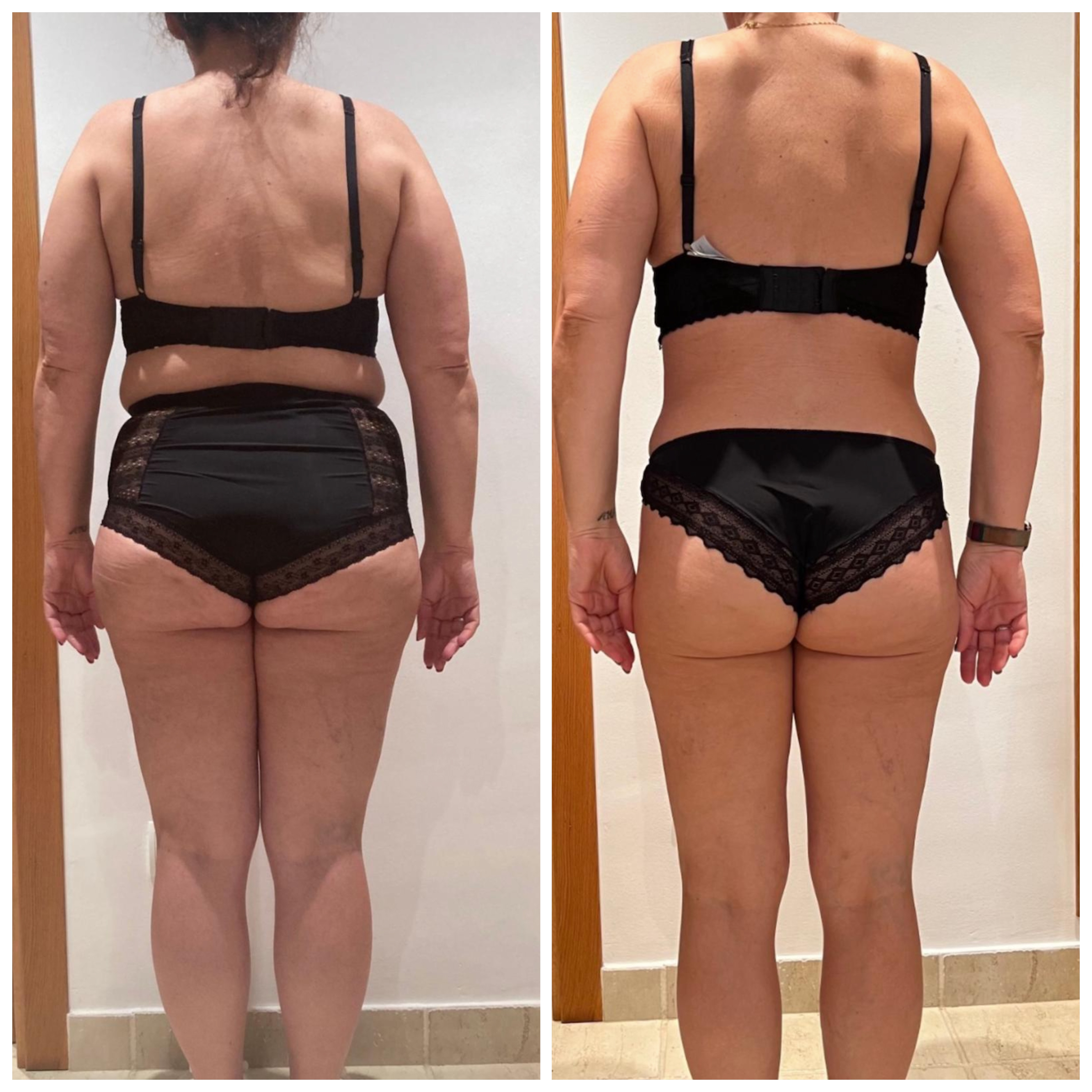 Transformación física